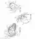 Fig. 06 - Interventional medical systems, devices, and methods of use
