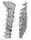 Fig. 42 - Deep brain stimulation lead