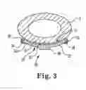 Fig. 04 - Paddle leads configured for suture fixation
