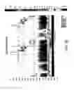 Fig. 29 - Device and implantation system for electrical stimulation of biological systems
