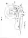 Fig. 04 - Event Detection In An Implantable Auditory Prosthesis