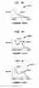 Fig. 07 - Event Detection In An Implantable Auditory Prosthesis