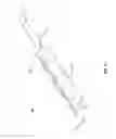 Fig. 14 - Leadless neurostimulator