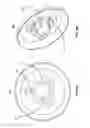 Fig. 48 - Leadless neurostimulator