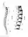 Fig. 52 - Leadless neurostimulator