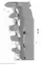 Fig. 54 - Leadless neurostimulator