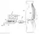 Fig. 01 - System and method for mapping arbitrary electric fields to pre-existing lead electrodes