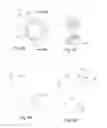 Fig. 08 - Systems and methods for making and using improved connector contacts for electrical stimulation systems