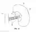 Fig. 35 - SYSTEM AND METHOD FOR OPTOGENETIC THERAPY