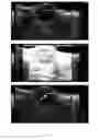Fig. 08 - Surfactant microbubbles and process for preparing and methods of using the same