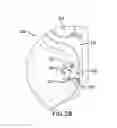 Fig. 04 - Deformable energy absorber with deformation indicator