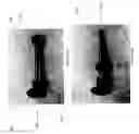 Fig. 25 - Weight lifting and selector pin assembly