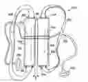 Fig. 01 - Proprioceptive feedback assist device and associated method