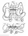 Fig. 02 - Proprioceptive feedback assist device and associated method