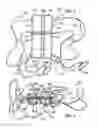 Fig. 03 - Proprioceptive feedback assist device and associated method