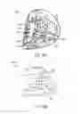 Fig. 45 - Golf club head