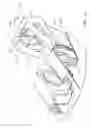 Fig. 12 - Demolition shear and demolition shear piercing tip insert and nose configuration