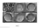 Fig. 04 - SURFACE STRUCTURING OF METALS