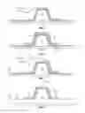 Fig. 03 - Method and system of forming a releasable support and method of pre-cure removal of a composite laminate