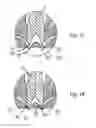 Fig. 16 - HOT CHANNEL SYSTEM