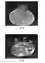Fig. 08 - Method for three-dimensional fabrication