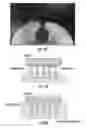 Fig. 10 - Method for three-dimensional fabrication