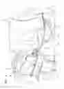 Fig. 04 - Swing arc HVAC duct