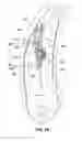 Fig. 20 - Lumbar support system
