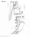 Fig. 11 - Front vehicle-body structure of vehicle
