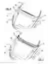 Fig. 05 - Deployable vehicle hood extender for pedestrian protection
