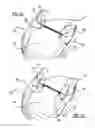 Fig. 12 - Deployable vehicle hood extender for pedestrian protection