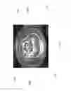 Fig. 02 - CAN COVER