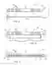 Fig. 03 - Bag Sealing Devices and Methods