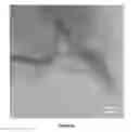 Fig. 04 - Producing graphene and nanoporous graphene