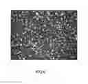 Fig. 03 - Composite material comprising a precious metal, manufacturing process and use of such material