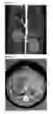 Fig. 02 - BIS AZAINOSITOL HAFNIUM COMPLEXES FOR X-RAY IMAGING