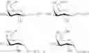 Fig. 12 - Thiosaccharide mucolytic agents