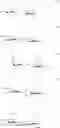 Fig. 86 - Thiosaccharide mucolytic agents
