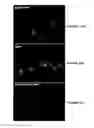 Fig. 16 - Endoplasmic reticulum localization signals