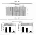 Fig. 12 - Development of Protein-Based Biotherapeutics That Penetrates Cell-Membrane and Induces Anti-Hepatocellular Carcinoma Effect - Improved Cell-Permeable Suppressor of Cytokine Signaling (iCP-SOCS3) Proteins, Polynucleotides Encoding the Same, and Anti-Hepatocellular Carcinoma Compositions Comprising the Same