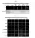 Fig. 04 - Development of Protein-Based Biotherapeutics That Penetrates Cell-Membrane and Induces Anti-Angiogenic Effect - Improved Cell-Permeable Suppressor of Cytokine Signaling (iCP-SOCS3) Proteins, Polynucleotides Encoding the Same, and Anti-Angiogenic Compositions Comprising the Same
