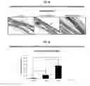 Fig. 24 - Development of Protein-Based Biotherapeutics That Induced Osteogenesis for Bone Healing Therapy: Cell-Permeable BMP2 and BMP7 Recombinant Proteins (CP-BMP2 & CP-BMP7), Polynucleotides Encoding the Same and Pro-osteogenic Compositions Comprising the Same