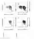Fig. 05 - Markers of acute myeloid leukemia stem cells