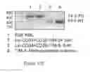 Fig. 21 - Markers of acute myeloid leukemia stem cells