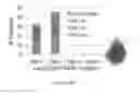 Fig. 23 - Markers of acute myeloid leukemia stem cells