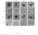 Fig. 09 - COMPOSITIONS AND METHODS FOR DETECTION AND TREATMENT OF HEPATOCELLULAR CARCINOMA