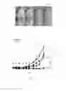 Fig. 12 - COMPOSITIONS AND METHODS FOR DETECTION AND TREATMENT OF HEPATOCELLULAR CARCINOMA