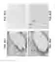 Fig. 20 - Anti-FAP antibodies and methods of use