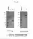 Fig. 30 - RAPID CLEARANCE OF ANTIGEN COMPLEXES USING NOVEL ANTIBODIES