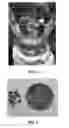 Fig. 03 - Methods and materials for depolymerizing polyesters